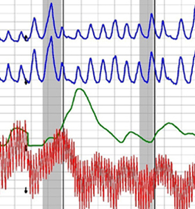 lie detector test in Alhambra